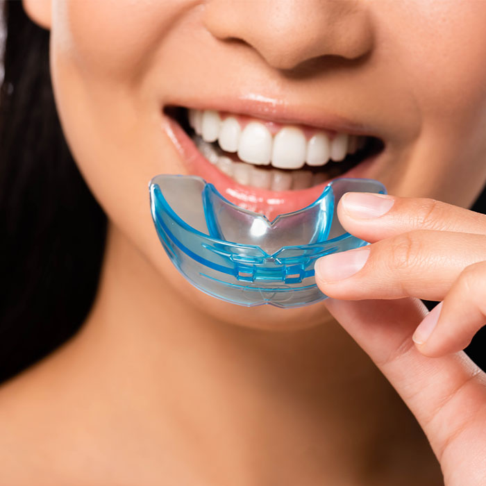 Mouth Guards