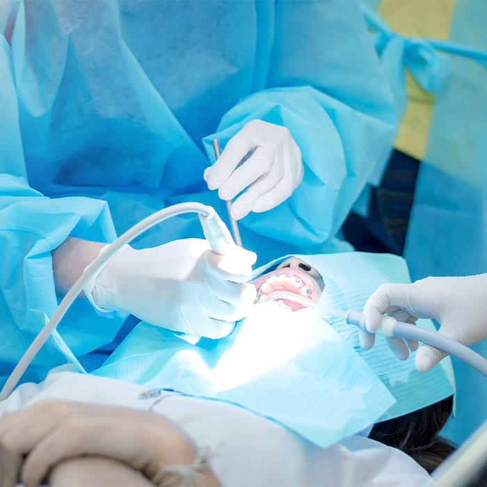 Root Canal Therapy