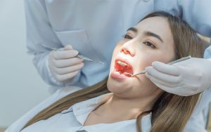 82 Dental - Patient with gum disease