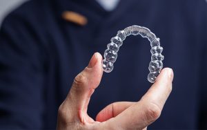 82 Dental - Dentist holding a pair of Invisalign
